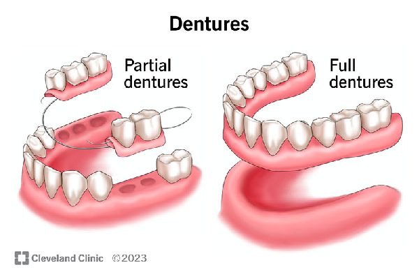 Dentures & Bridges